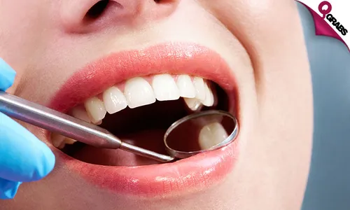 Teeth Scaling, Polishing, Consultation & More!